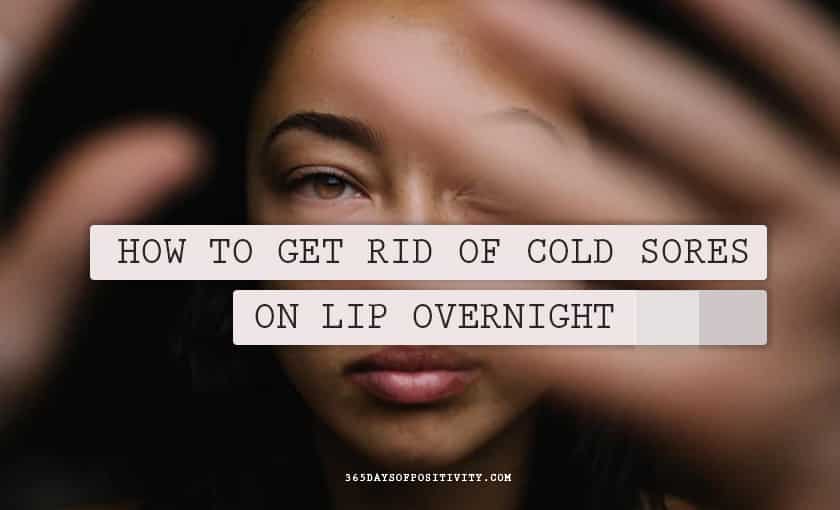 How To Get Rid of Cold Sores On Lip Overnight